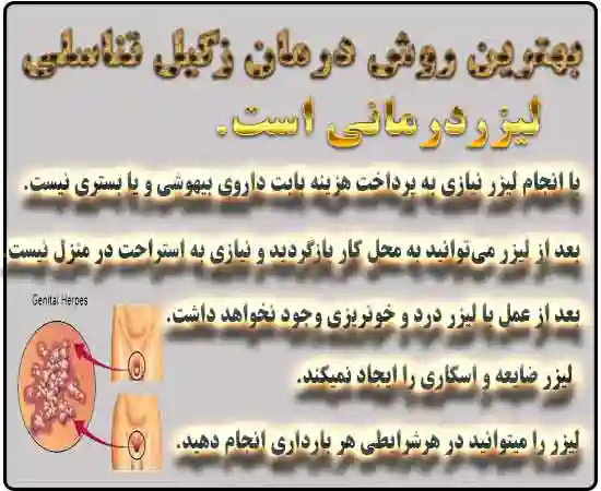 ,زگیل تناسلی,